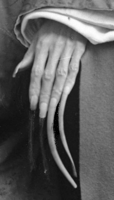 Long Fingernails of Chinese Doctor (1920)